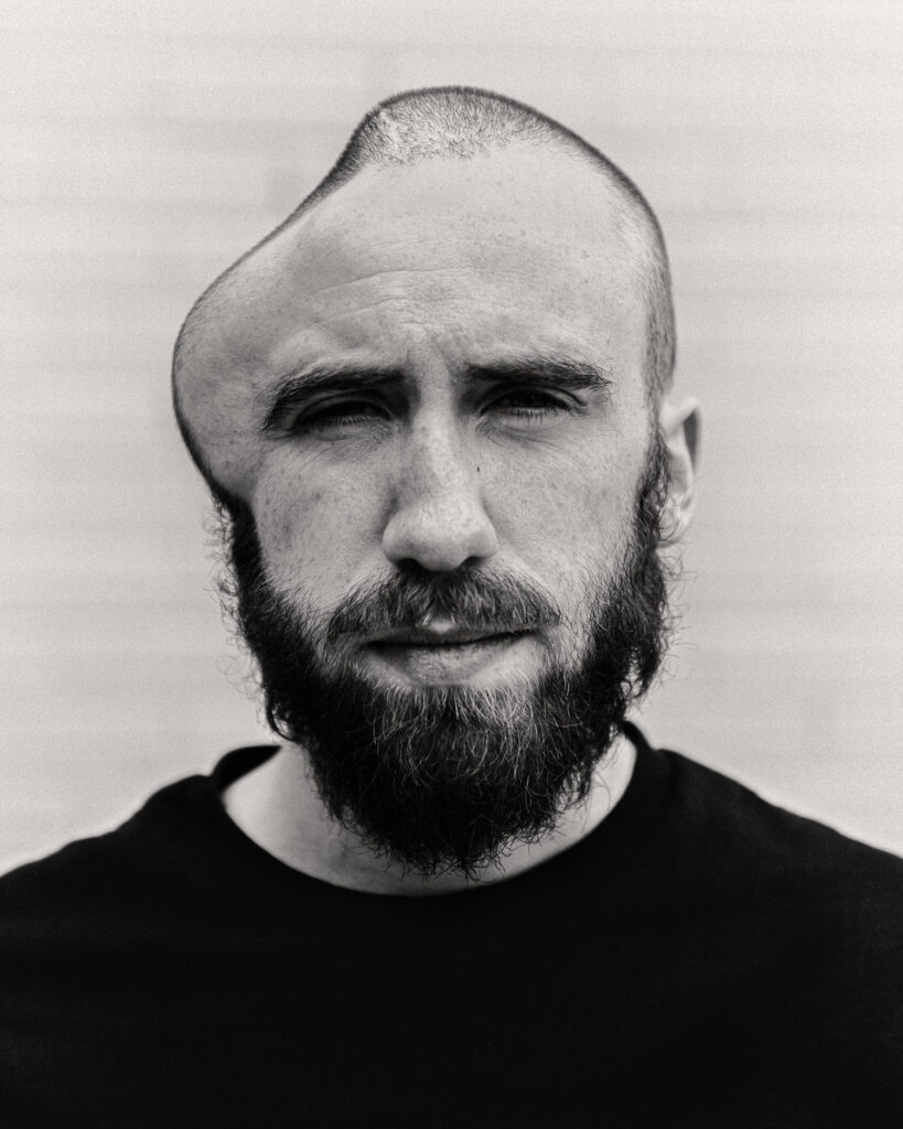 black and white portrait of a man with a misshapen head. photo by Wilhelm Philipp